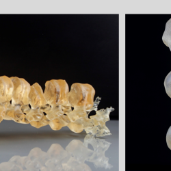 Verkruemmte Wirbelsaele Additive Fertigung IMPETUS_3